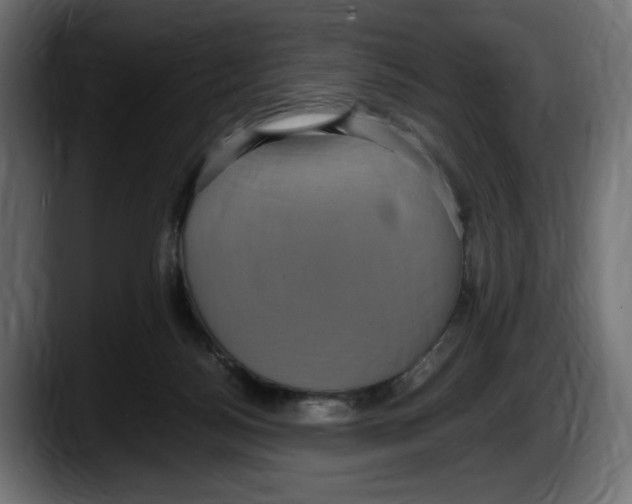 X0000087520172200705251646