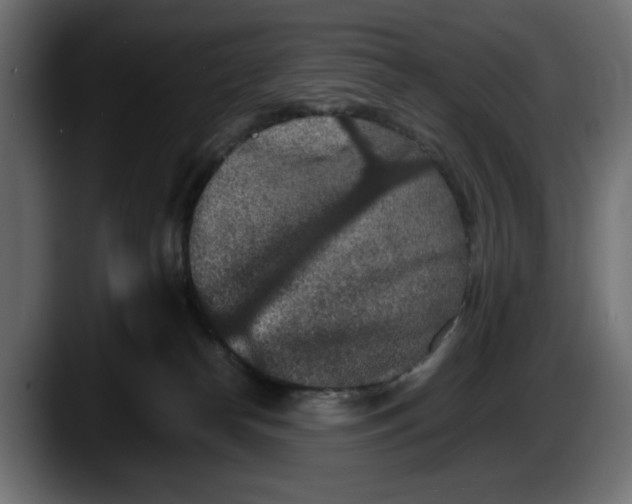 X0000087520182200705251646