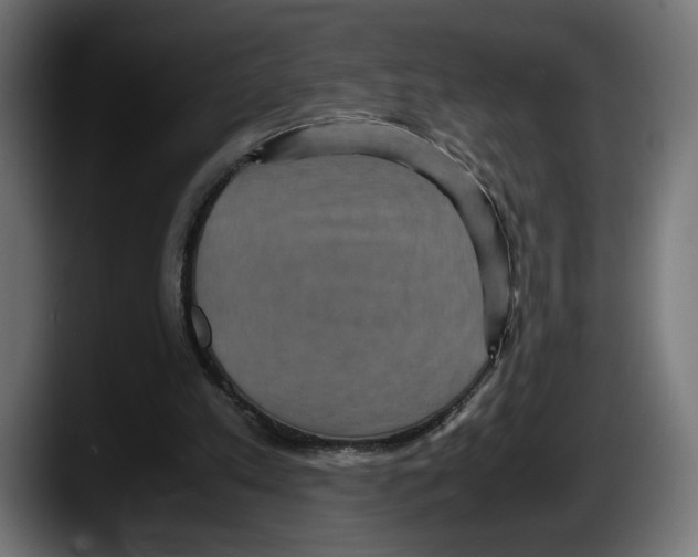 X0000087520197200705251646