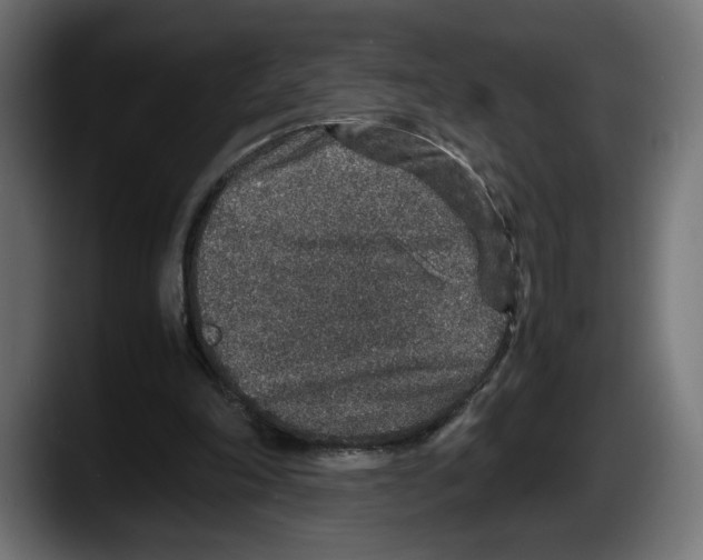 X0000087520198200705251646