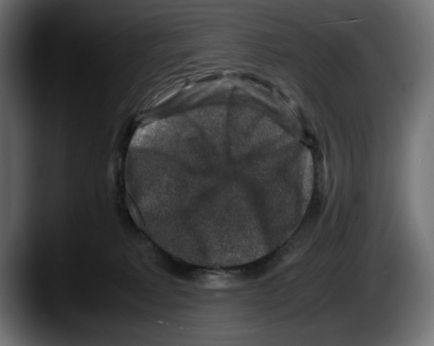 X0000087520229200705251645