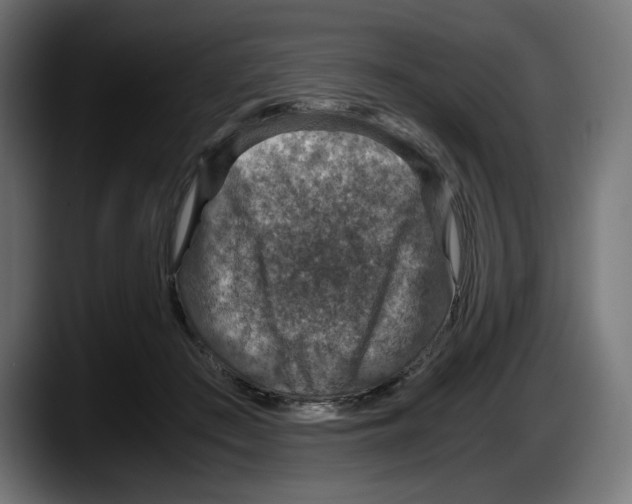 X0000087520409200705251643