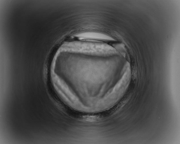 X0000087520448200705251642