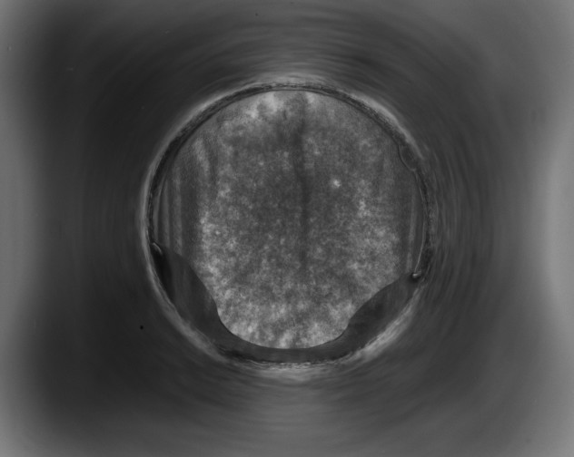 X0000087521038200705251635