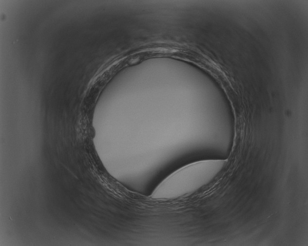 X0000087531448200704270845