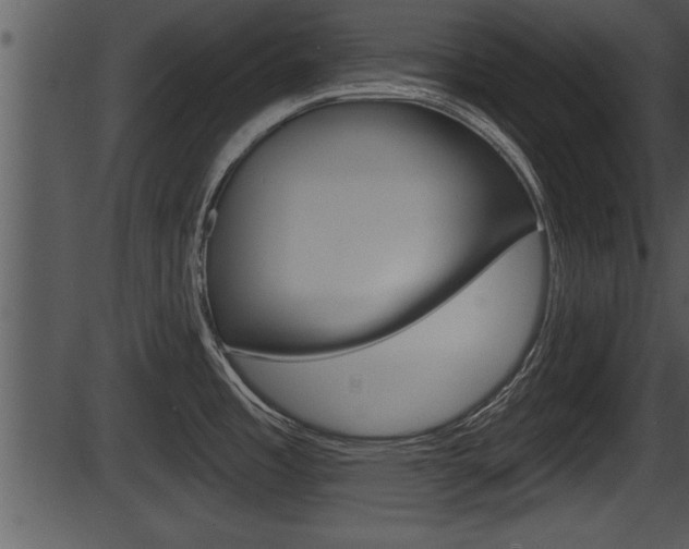 X0000087531485200704270844