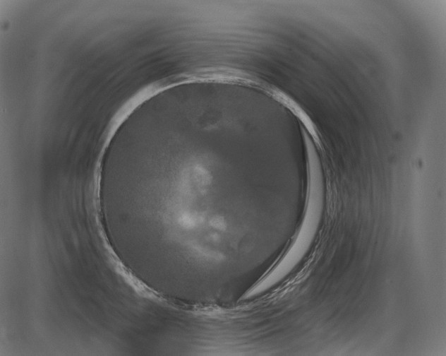 X0000087531099200704271201