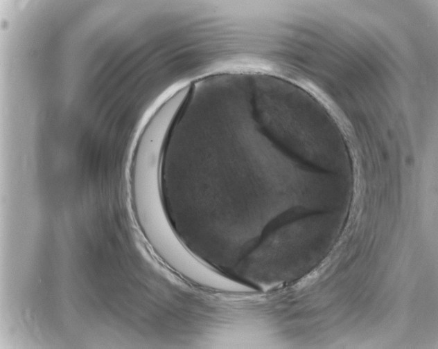 X0000087530864200705041236