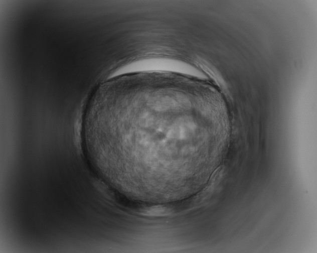 X0000087530058200705181038