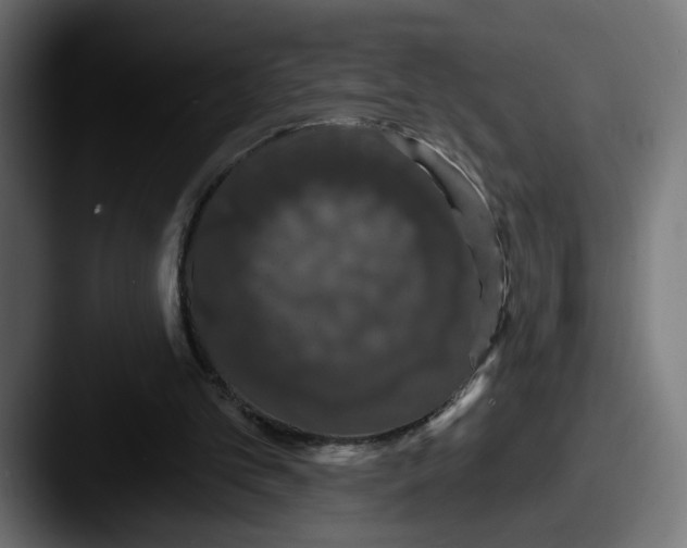 X0000087530101200705181038