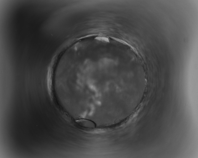 X0000087530149200705181037