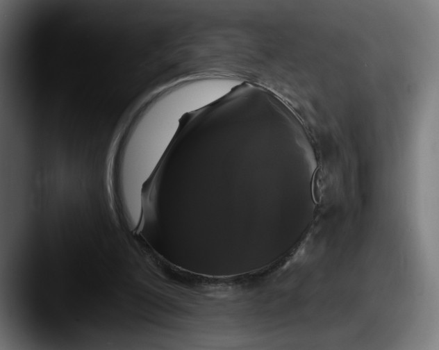 X0000087530200200705181036