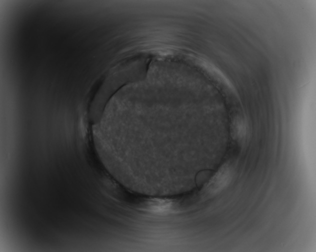 X0000087530328200705181035