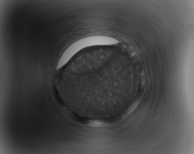 X0000087530380200705181035