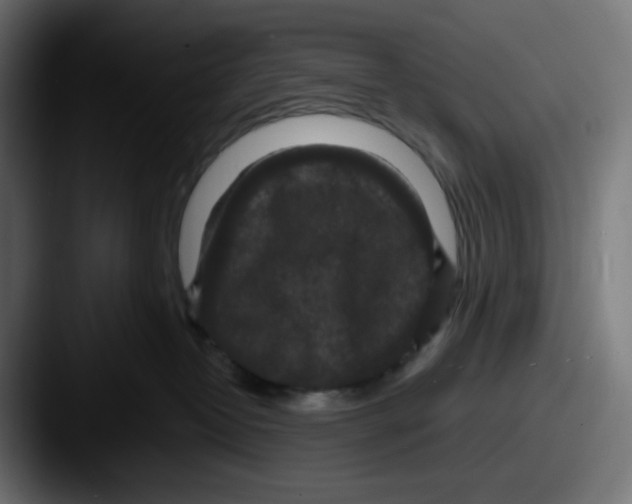 X0000087530382200705181035