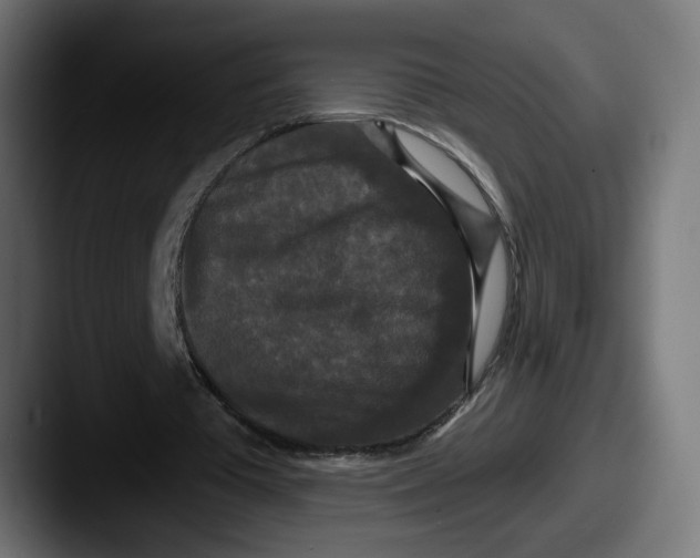 X0000087530385200705181034