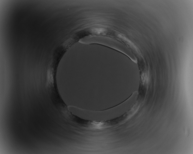 X0000087530570200705181033