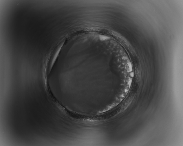 X0000087530729200705181030