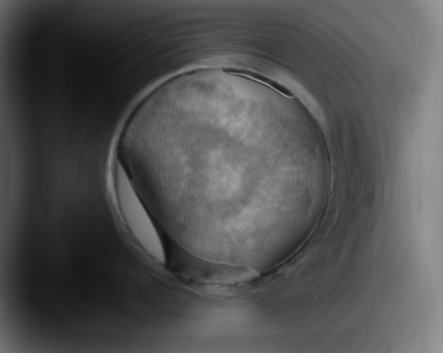 X0000087530960200705181028