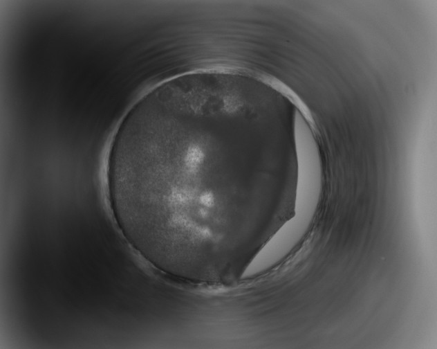 X0000087531099200705181026