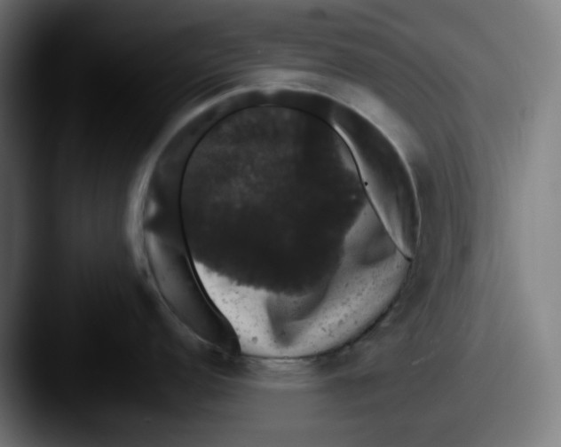 X0000087531152200705181026