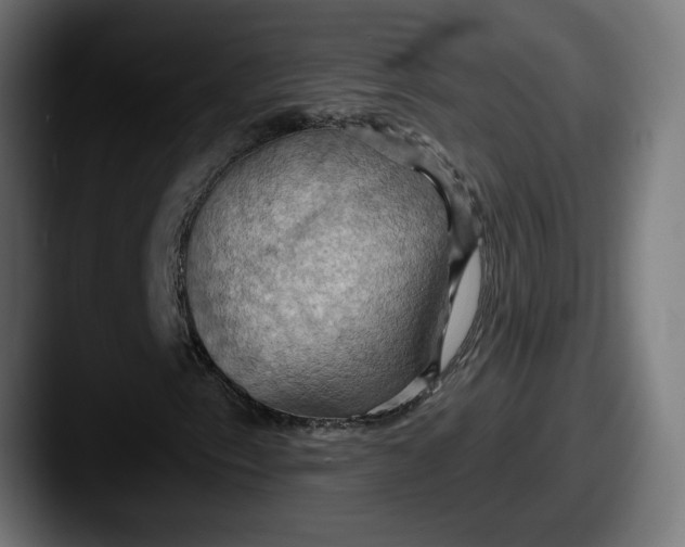 X0000087531153200705181025