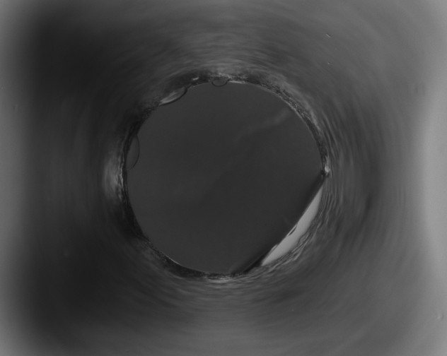 X0000087531155200705181025