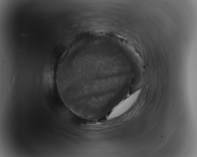 X0000087531156200705181025