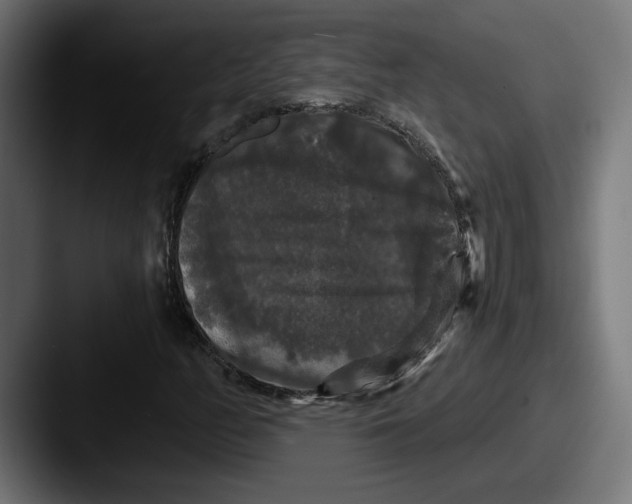 X0000087531158200705181025