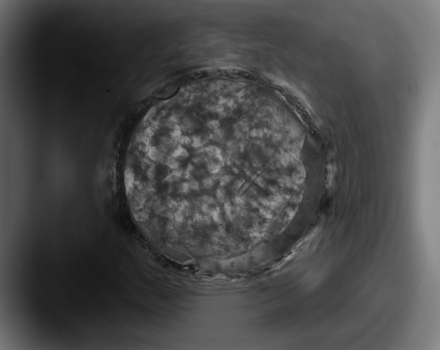 X0000087531159200705181025