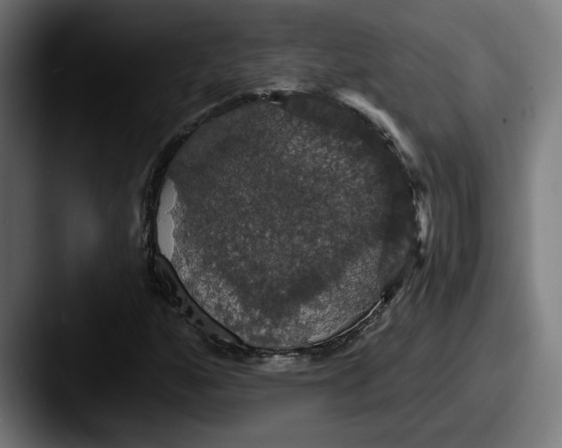 X0000087531160200705181025