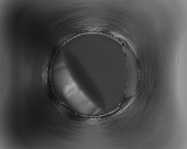 X0000087531161200705181025