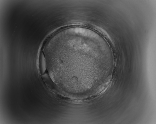 X0000087531172200705181025