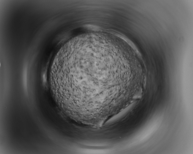 X0000087531198200705181025