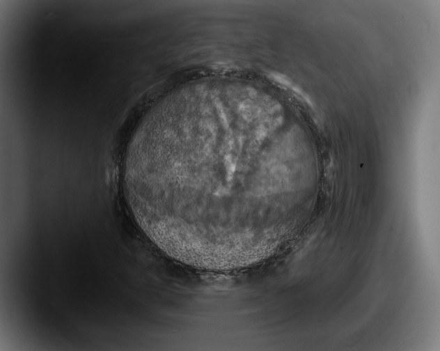 X0000087531302200705181023