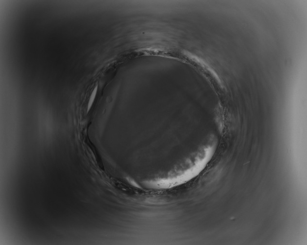 X0000087531399200705181022