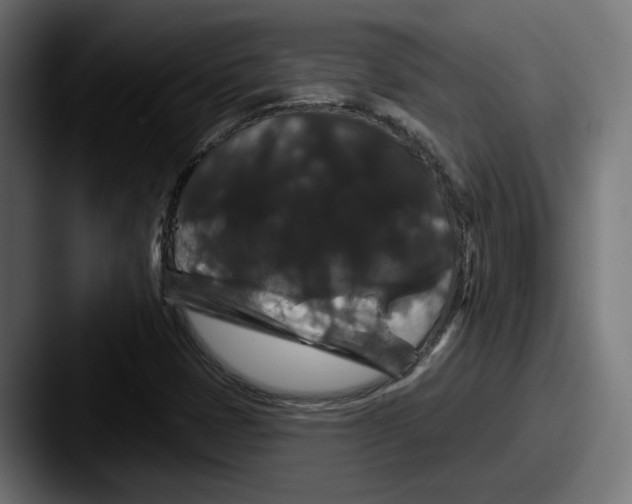 X0000087531401200705181022