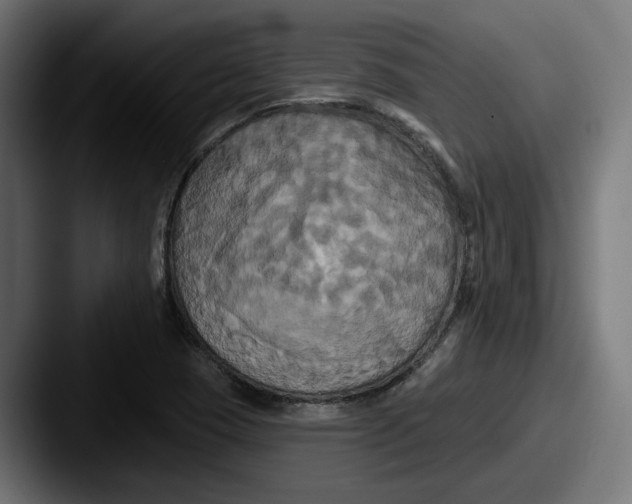 X0000087531409200705181022