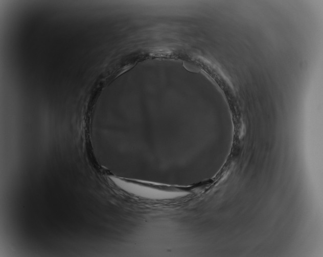 X0000087531445200705181022