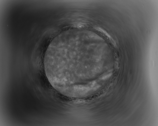 X0000087531446200705181022