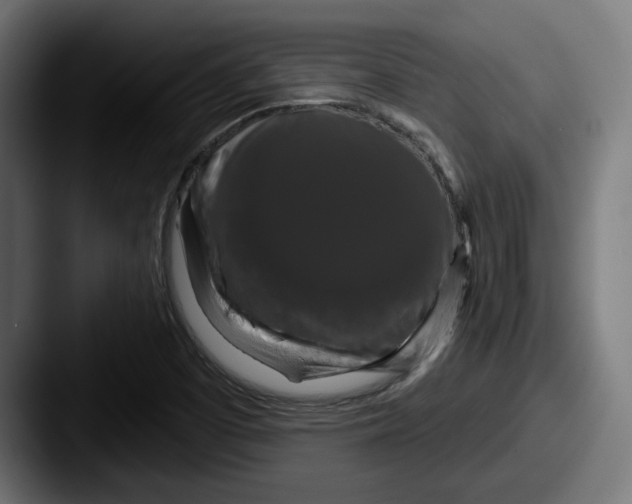 X0000087531457200705181022