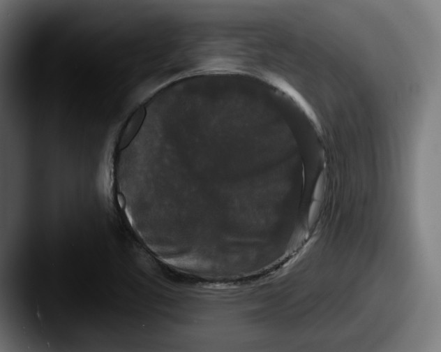 X0000087531461200705181022