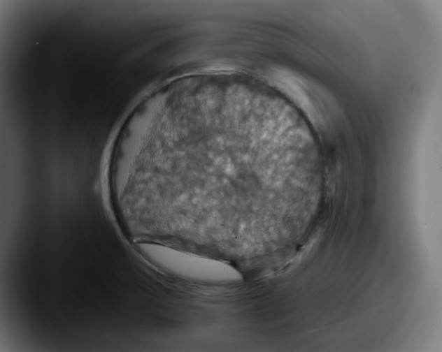 X0000087531475200705181021