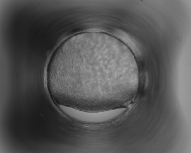 X0000087531476200705181021