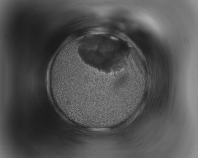 X0000087531487200705181021