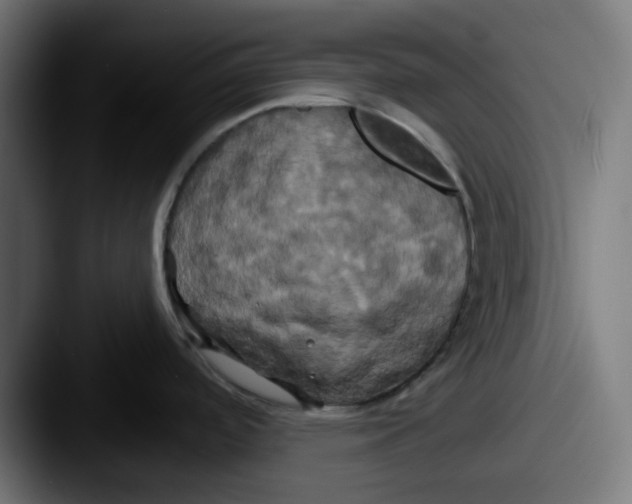 X0000087531488200705181021