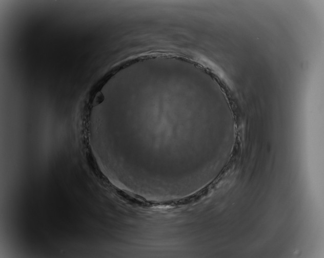 X0000087531496200705181021