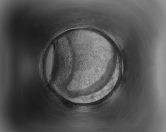 X0000087531501200705181021