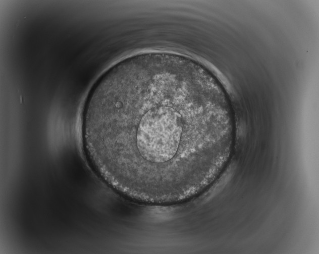 X0000087531514200705181021