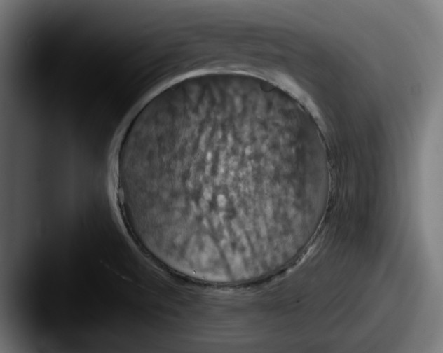 X0000087531520200705181021